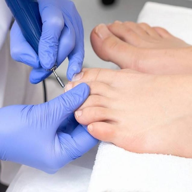Podiatrist in Glasgow Southside